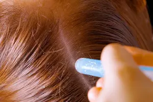 Tour image of Tokyo Ginza Head Spa Trial：Scalp Care 75